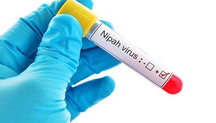দেশে নিপা ভাইরাসে ৫ জনের মৃত্যু 1 nipa