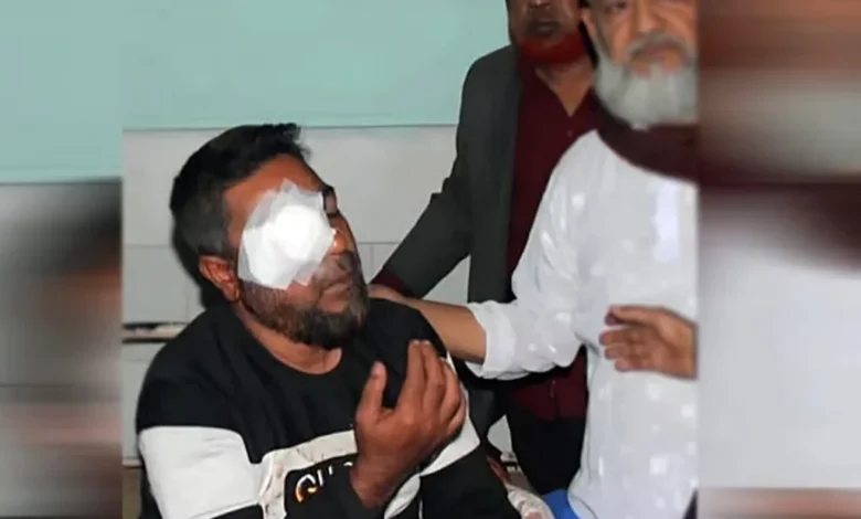 জামায়াতের হা/মলায় বিএনপি নেতার চোখে জখম, দৃষ্টি হারানোর খবর শুনে মায়ের মৃ/ত্যু 1 e877ec79de4ab54e74da7d0f9bfb3d0a 698c2c83052e5